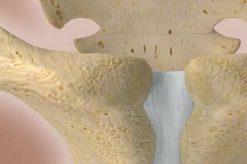 dogumsal-kalca-cikigi