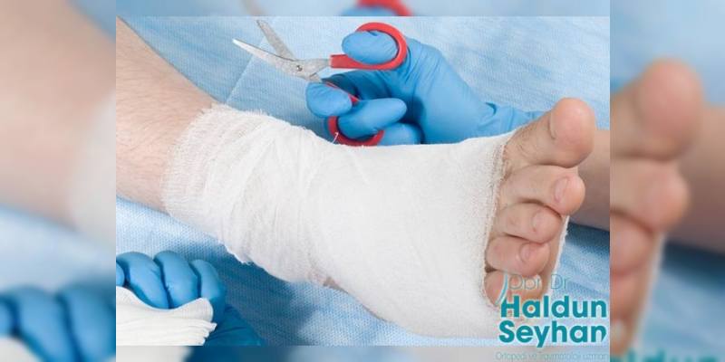 Aşil Yırtığı Nedenleri