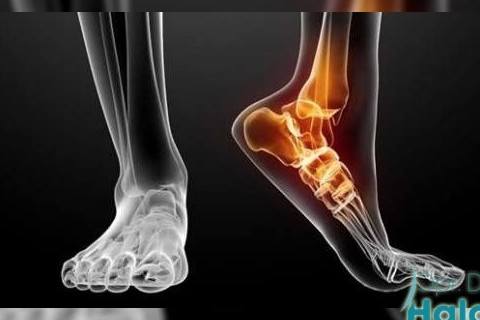 ayak-bilegi-artroskopisi