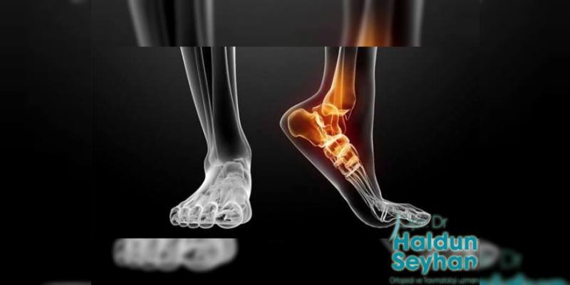 Ayak Bileği Artroskopisi