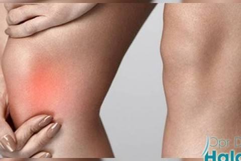 diz-kireclenmesi-nasil-tedavi-edilir