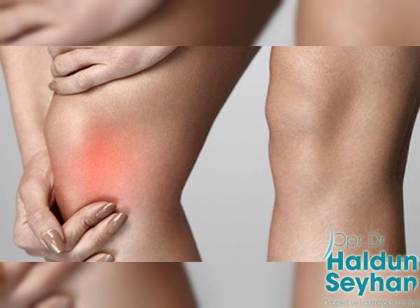 diz-kireclenmesi-nasil-tedavi-edilir