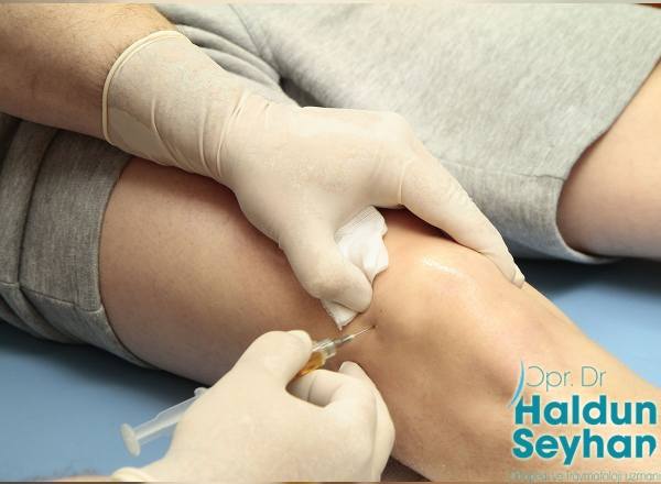 diz-kireclenmesi-problemlerinde-prp-tedavisi