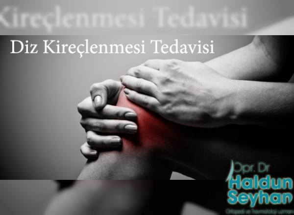 diz-kireclenmesi-tedavisi