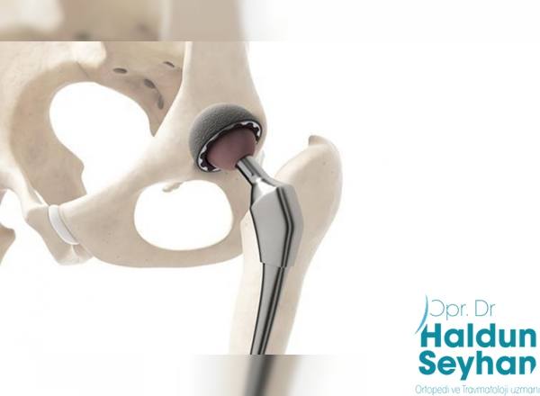 kalça protezi