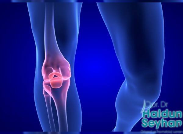 meniskus-nedir