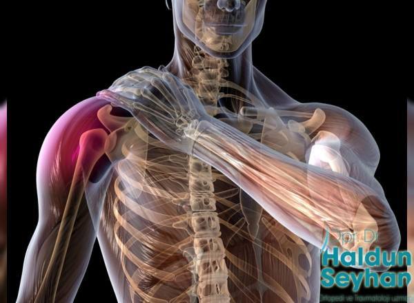 omuz-yirtigi-tedavisi
