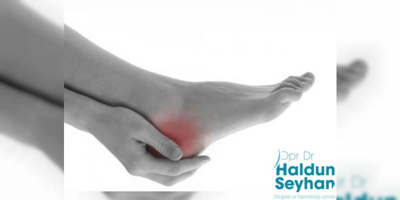 Topuk Dikeni Egzersizi