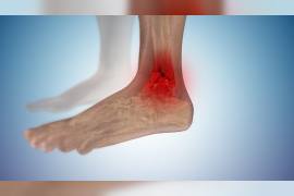 ayak-bilegi-kiriklari