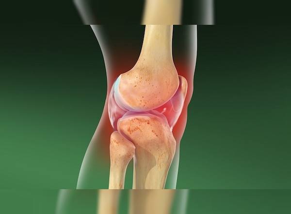 diz-kireclenmesi-nedir