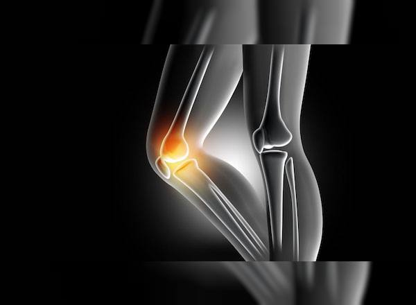 kireclenme-ve-diz-protezi